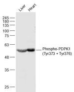 Phospho-PDPK1 (Tyr373, Tyr376) Antibody in Western Blot (WB)