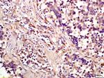 Phospho-eIF4EBP1 (Ser65) Antibody in Immunohistochemistry (Paraffin) (IHC (P))