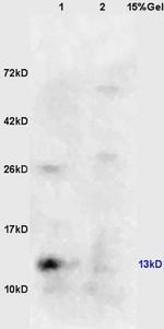 Phospho-eIF4EBP1 (Ser65) Antibody in Western Blot (WB)