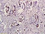 Phospho-e4EBP1 (Thr37, Thr46) Antibody in Immunohistochemistry (Paraffin) (IHC (P))