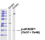 Phospho-e4EBP1 (Thr37, Thr46) Antibody in Western Blot (WB)