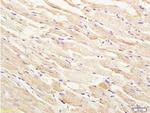 Phospho-ASK1 (Thr845) Antibody in Immunohistochemistry (Paraffin) (IHC (P))