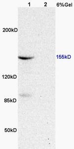 Phospho-ASK1 (Thr845) Antibody in Western Blot (WB)