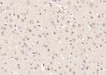Phospho-ATF2 (Thr69, Thr71) Antibody in Immunohistochemistry (Paraffin) (IHC (P))