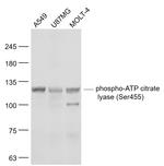 Phospho-ATP citrate lyase (Ser455) Antibody in Western Blot (WB)