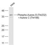 Phospho-Aurora B (Thr198) Antibody in Western Blot (WB)