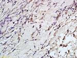 Phospho-Aurora A (Thr288) Antibody in Immunohistochemistry (Paraffin) (IHC (P))