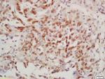 Phospho-BTK (Tyr223) Antibody in Immunohistochemistry (Paraffin) (IHC (P))