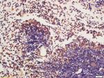 Phospho-BTK (Tyr223) Antibody in Immunohistochemistry (Paraffin) (IHC (P))