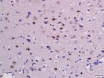 Phospho-beta Catenin (Ser33, Ser37) Antibody in Immunohistochemistry (Paraffin) (IHC (P))