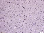 Phospho-beta Catenin (Ser33, Ser37) Antibody in Immunohistochemistry (Paraffin) (IHC (P))