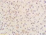 Phospho-Beta Catenin (Thr41, Ser45) Antibody in Immunohistochemistry (Paraffin) (IHC (P))