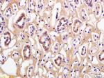 Phospho-Beta Catenin (Thr41, Ser45) Antibody in Immunohistochemistry (Paraffin) (IHC (P))