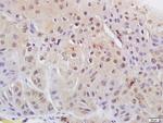 Phospho-CDK1 (Tyr15) Antibody in Immunohistochemistry (Paraffin) (IHC (P))