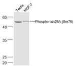 Phospho-cdc25A (Ser76) Antibody in Western Blot (WB)
