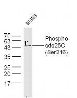 Phospho-cdc25C (Ser216) Antibody in Western Blot (WB)