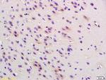 Phospho-Cofilin (Ser3) Antibody in Immunohistochemistry (Paraffin) (IHC (P))