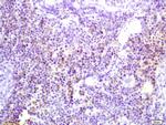 Phospho-DOK2 (Tyr139) Antibody in Immunohistochemistry (Paraffin) (IHC (P))