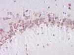 Phospho-Dab1 (Ser524) Antibody in Immunohistochemistry (Paraffin) (IHC (P))