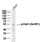 Phospho-Dab1 (Ser524) Antibody in Western Blot (WB)