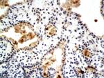 Phospho-Estrogen Receptor alpha (Ser104, Ser106) Antibody in Immunohistochemistry (Paraffin) (IHC (P))