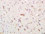 Phospho-FGFR1 (Tyr766) Antibody in Immunohistochemistry (Paraffin) (IHC (P))