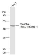 Phospho-FOXO4/FOXO1 (Ser197, Ser256) Antibody in Western Blot (WB)