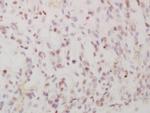 Phospho-FRA1 (Ser265) Antibody in Immunohistochemistry (Paraffin) (IHC (P))