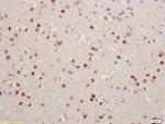 Phospho-Histone H1.4 (Thr18) Antibody in Immunohistochemistry (Paraffin) (IHC (P))