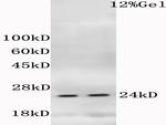 Phospho-Histone H1.4 (Thr18) Antibody in Western Blot (WB)