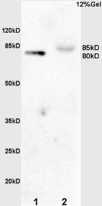 Phospho-GAB2 (Tyr452) Antibody in Western Blot (WB)