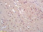 Phospho-Histone H3 (Ser28) Antibody in Immunohistochemistry (Paraffin) (IHC (P))