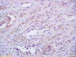 Phospho-IRAK1 (Thr387) Antibody in Immunohistochemistry (Paraffin) (IHC (P))