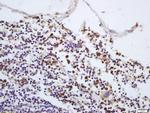Phospho-IRAK1 (Thr387) Antibody in Immunohistochemistry (Paraffin) (IHC (P))