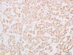 Phospho-IRS1 (Tyr612) Antibody in Immunohistochemistry (Paraffin) (IHC (P))