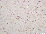 Phospho-IKK beta (Tyr199) Antibody in Immunohistochemistry (Paraffin) (IHC (P))