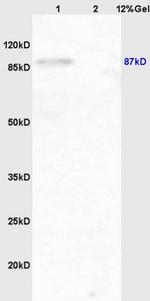 Phospho-IKK beta (Tyr199) Antibody in Western Blot (WB)