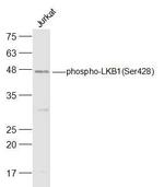 Phospho-LKB1 (Ser428) Antibody in Western Blot (WB)