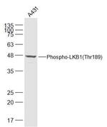 Phospho-LKB1 (Thr189) Antibody in Western Blot (WB)