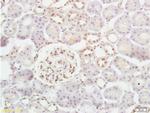 Phospho-5-Lipoxygenase (Ser663) Antibody in Immunohistochemistry (Paraffin) (IHC (P))