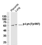 Phospho-Lyn (Tyr397) Antibody in Western Blot (WB)