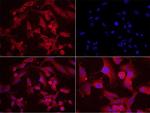 Phospho-MAP2 (Ser136) Antibody in Immunocytochemistry (ICC/IF)
