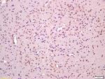Phospho-MAPKAPK2 (Thr334) Antibody in Immunohistochemistry (Paraffin) (IHC (P))