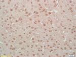 Phospho-MEF2A (Ser408) Antibody in Immunohistochemistry (Paraffin) (IHC (P))
