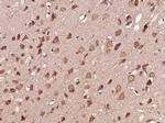 Phospho-MEK1 (Thr286) Antibody in Immunohistochemistry (Paraffin) (IHC (P))