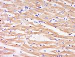 Phospho-MEK6 (Ser202) Antibody in Immunohistochemistry (Paraffin) (IHC (P))