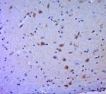 Phospho-MLK3 (Thr277, Ser281) Antibody in Immunohistochemistry (Paraffin) (IHC (P))