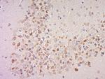 Phospho-MSK1 (Ser360) Antibody in Immunohistochemistry (Paraffin) (IHC (P))