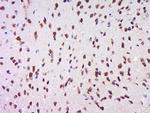 Phospho-MSK1 (Ser212) Antibody in Immunohistochemistry (Paraffin) (IHC (P))