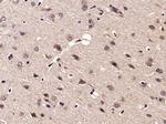Phospho-NDRG1 (Thr346) Antibody in Immunohistochemistry (Paraffin) (IHC (P))
